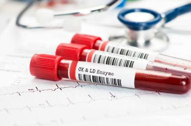 Blood Test