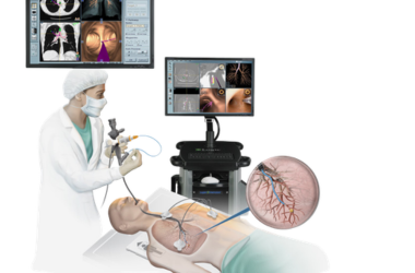 Bronchoscopy