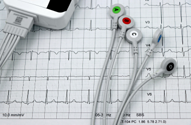 ECG