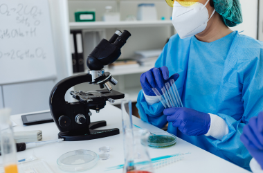 Sputum Culture Test