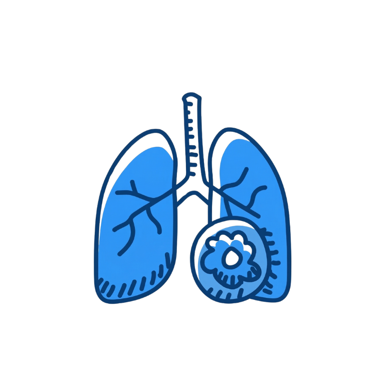Pneumonia