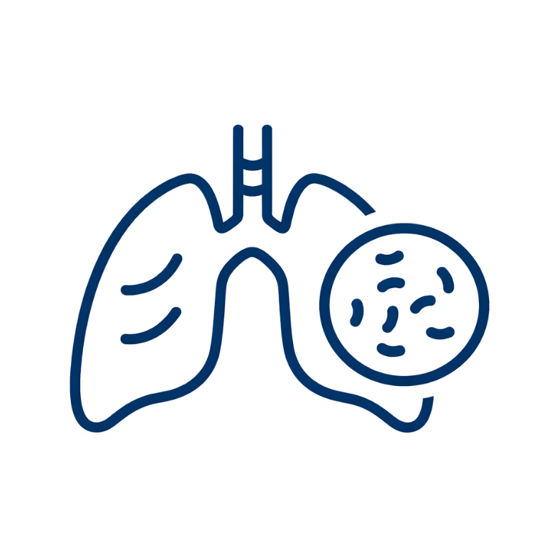 Tuberculosis (TB)